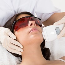 Laser Treatment