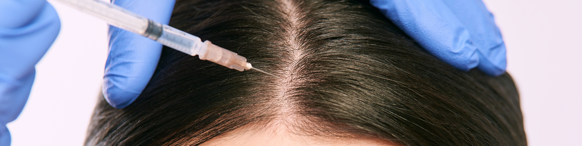 Dallas PRP Hair Restoration | Yaker Hair Restoration | Med Spa Dallas PRP Hair Restoration | Yaker Hair Restoration | Med Spa